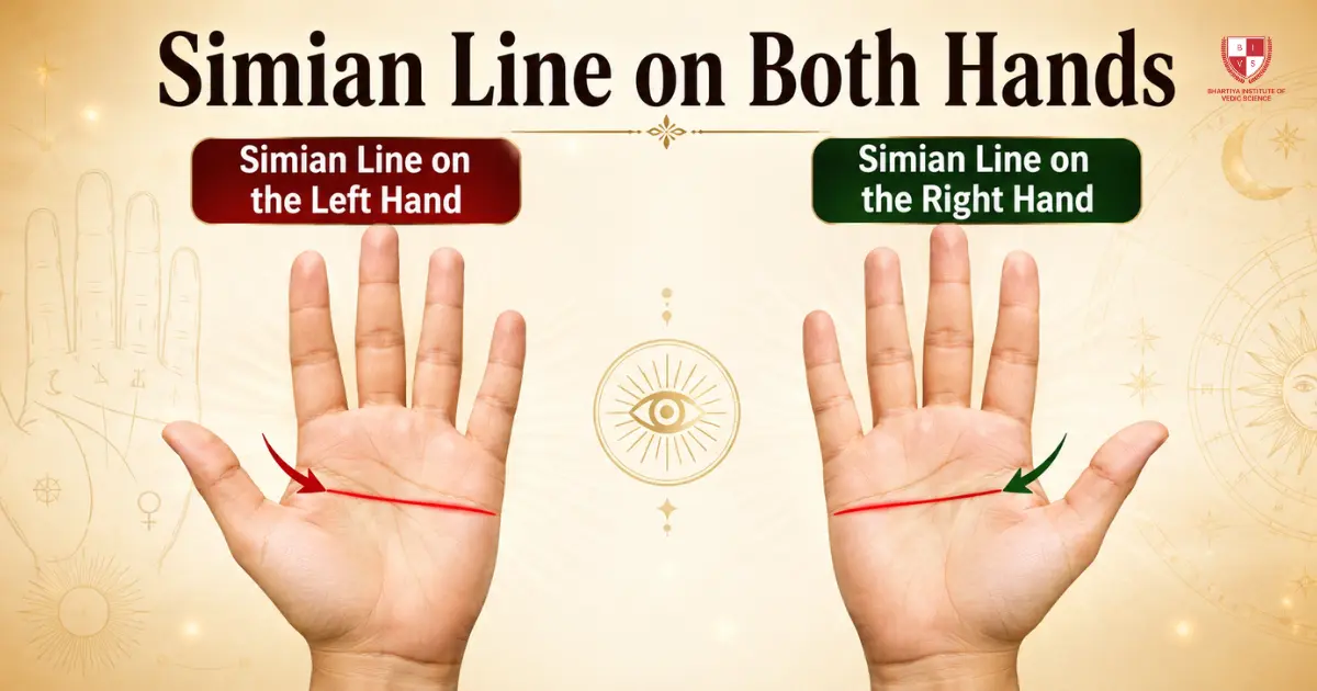 Simian Line on Both Hands